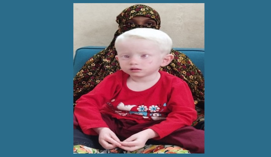 আলোচিত শ্বেতবর্ণ  শিশুর ডিএনএ পরীক্ষার আবেদন