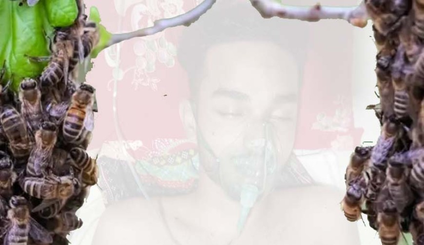 অচমকা ধেয়ে এলো মৌমাছির ঝাঁক, হুলের আঘাতে কিশোর হাসপাতালে