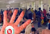 হাম ও হামের উপসর্গ নিয়ে দেশে আরও ১১ শিশুর মৃত্যু