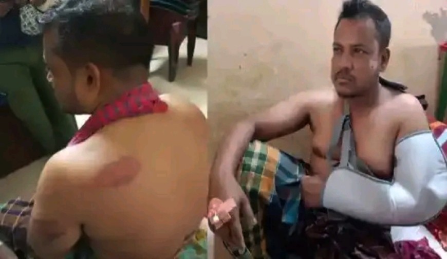 জামায়াত নেতার ওপর সন্ত্রাসী হামলা, বিকেলে সংবাদ সম্মেলন
