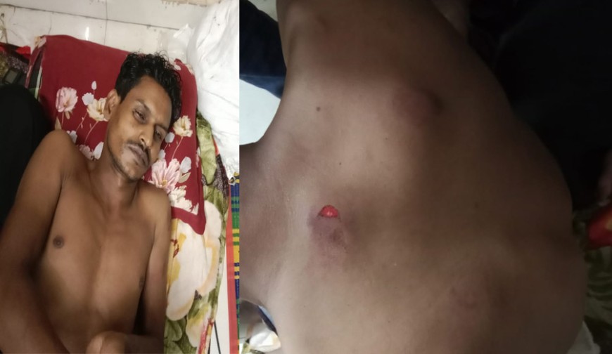 বেনাপোলে চাঁদা না পেয়ে পল্লী চিকিৎসককে হাতুড়িপেটা