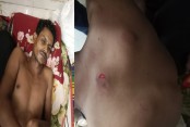 বেনাপোলে চাঁদা না পেয়ে পল্লী চিকিৎসককে হাতুড়িপেটা