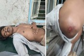 অভয়নগরে ছাত্রশক্তির নেতার ওপর হামলা